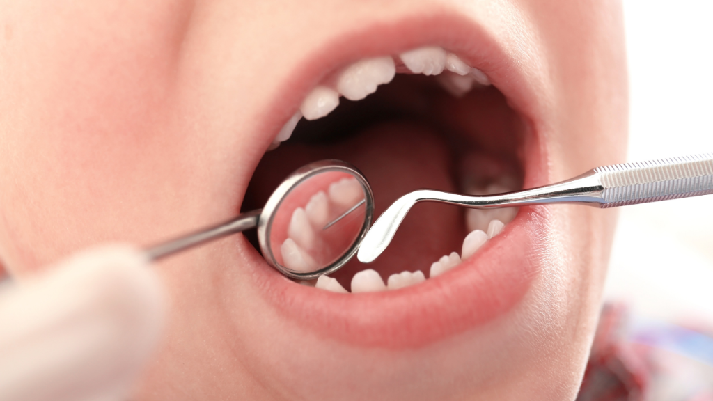 Orthodontic Concerns When Teeth Dont Line Up - Teeth Problems for Kids - The Big Tooth