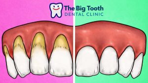 5 brushing mistakes