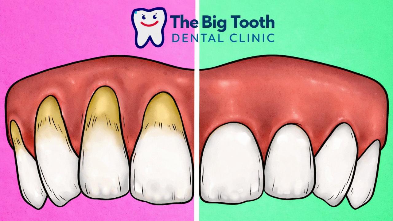 5 brushing mistakes